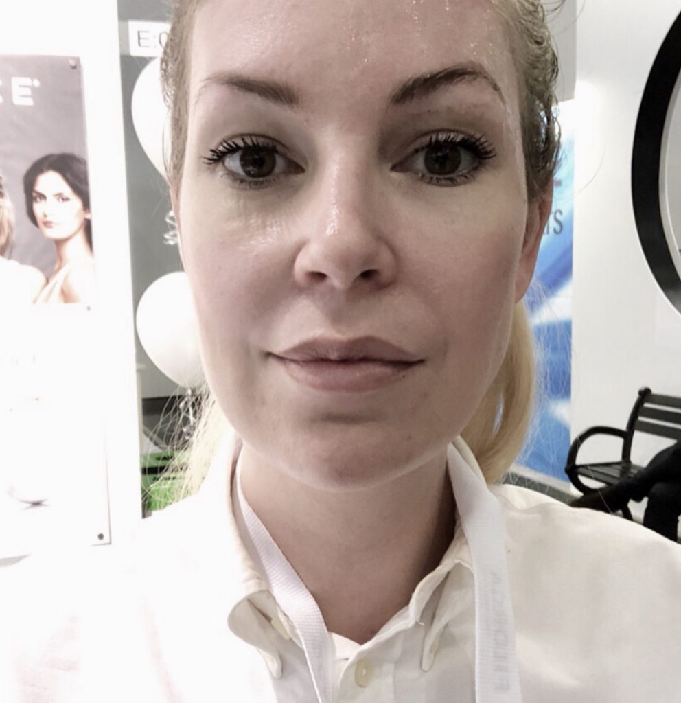 Före och efterbild på Nuface