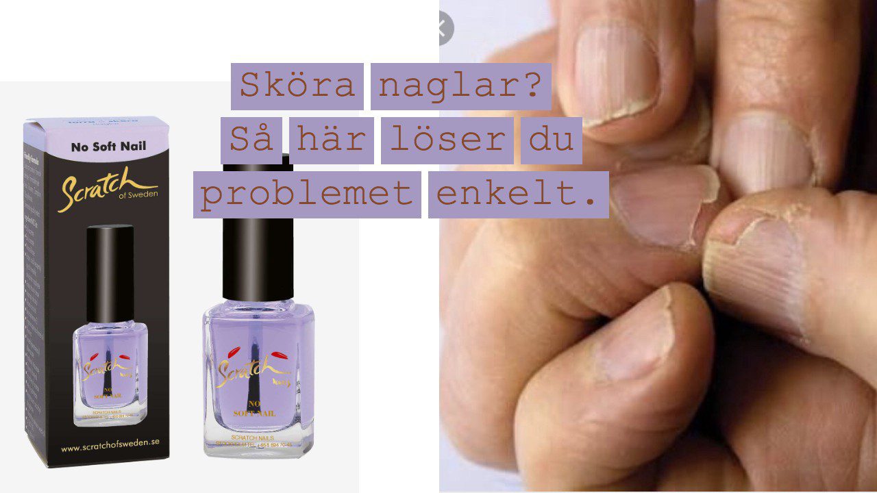 sköra naglar