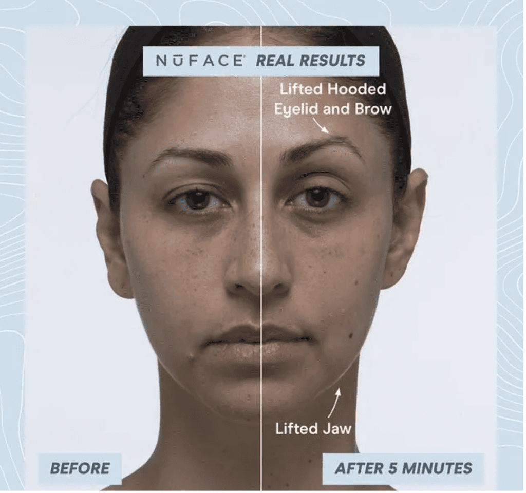 Recension NuFACE Trinity+ and Effective Lip and Eye Attachment Set