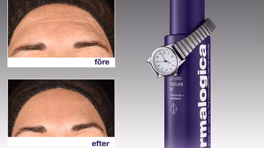 Phyto Nature E² är en regenererande exosompeeling som väcker och påskyndar hudens cellförnyelse